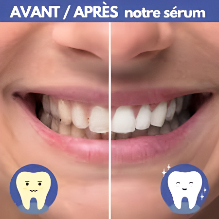 BLEEX | SÉRUM BLANCHISSANT